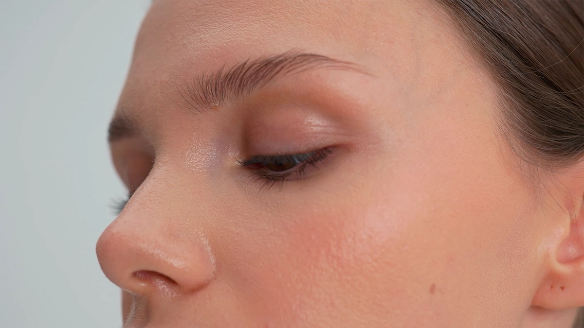 What is Brow Lift