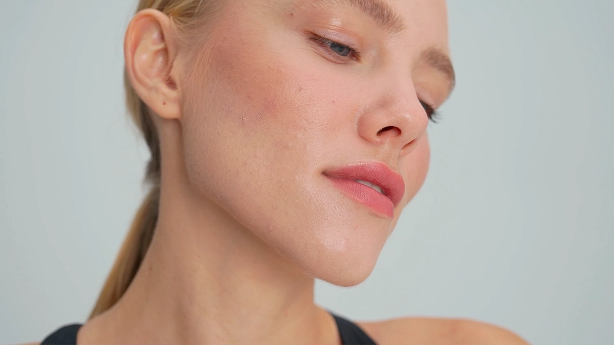 Chin augmentation aesthetic turkey