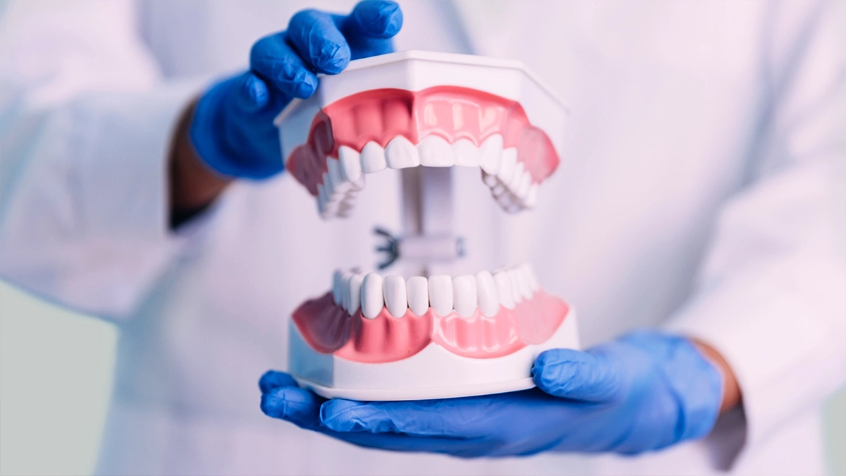 What are the Types of Dentures?