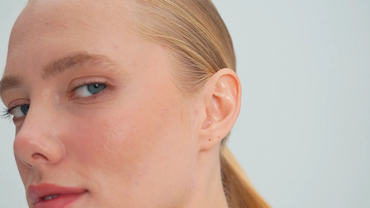 Phoenix Face Operation Ear Surgery