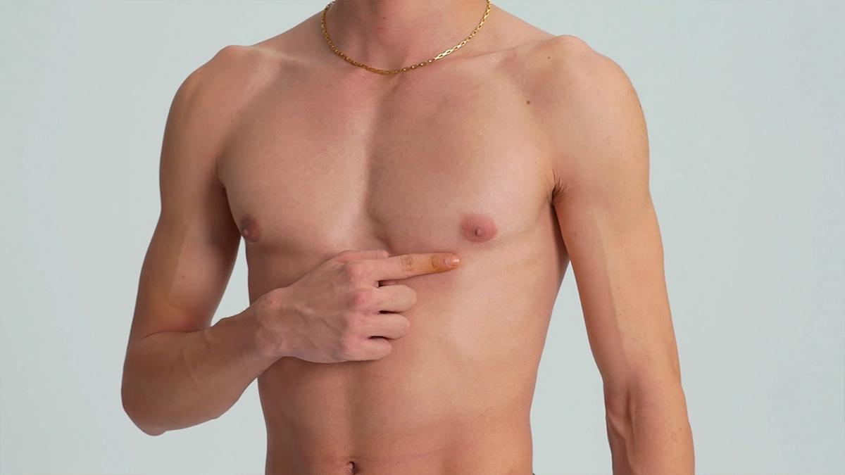 Gynecomastia Surgery Aesthetic Turkey