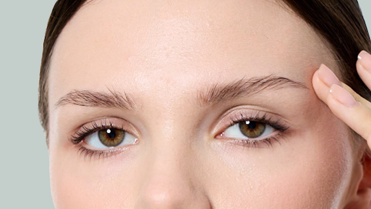 How is brow lift performed in turkey