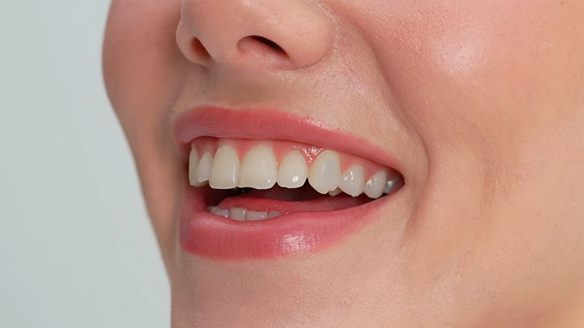 Phoenix Teeth Reshaping