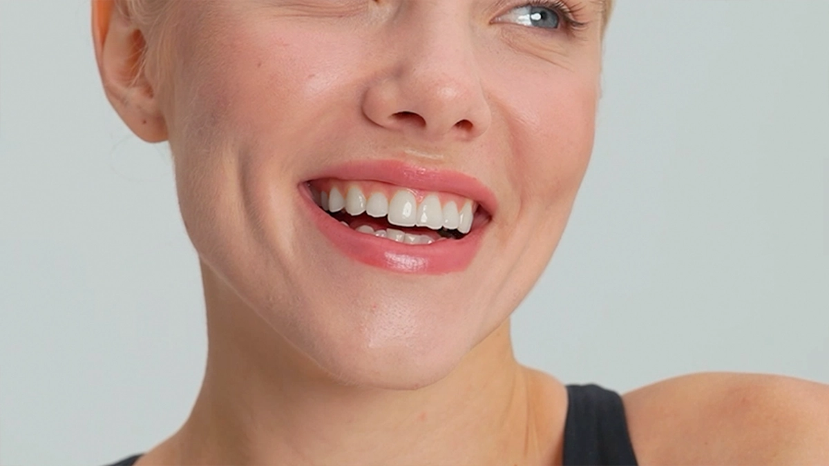 Teeth Veneers Turkey