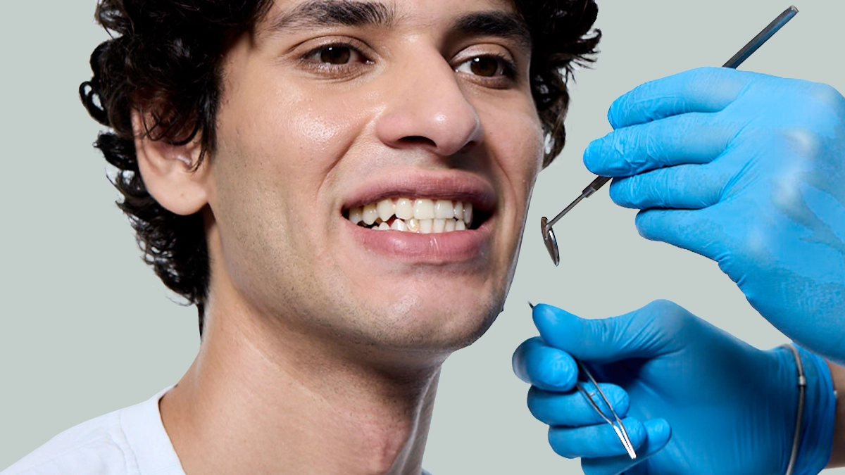 Diş Tutucular Nedir?