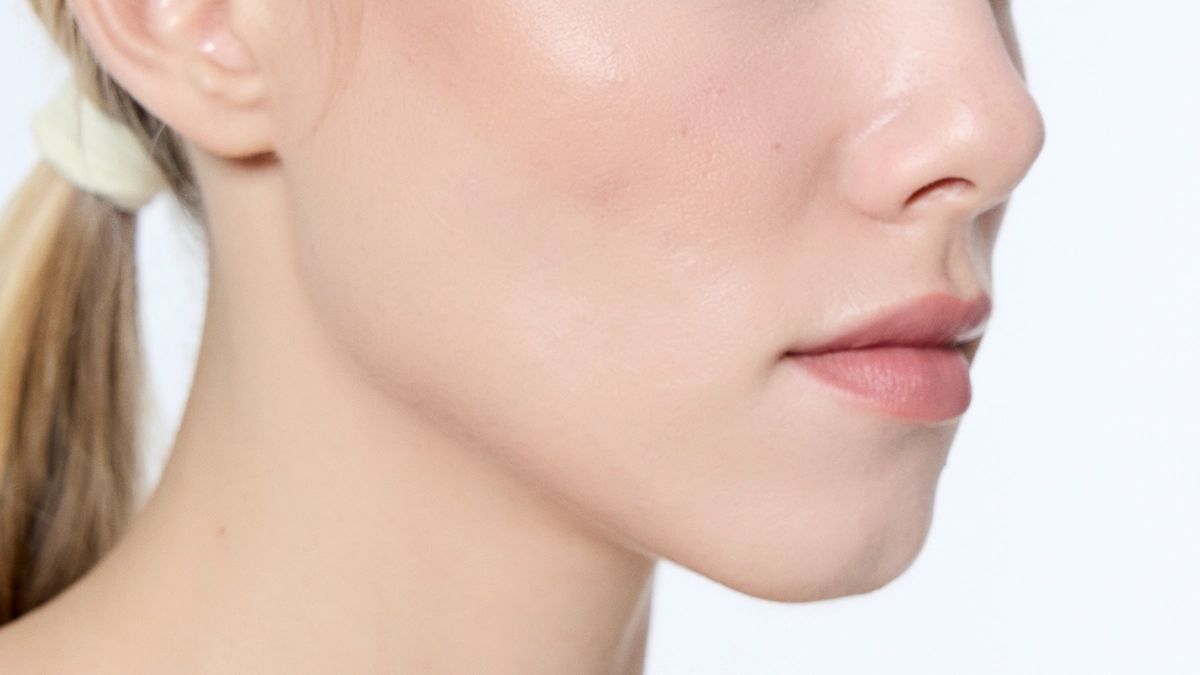 Buccal Fat Removal Cheek Contouring Turkey
