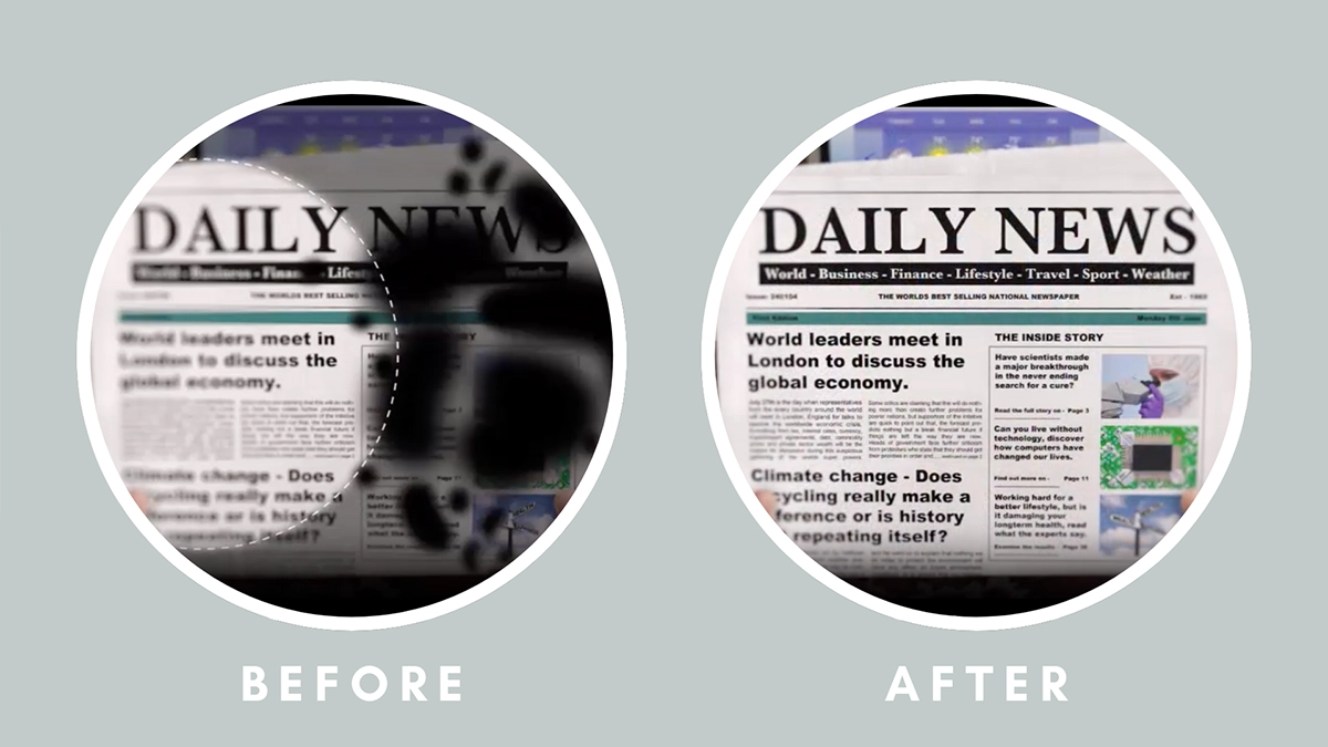 Senile Macular Degeneration Before After