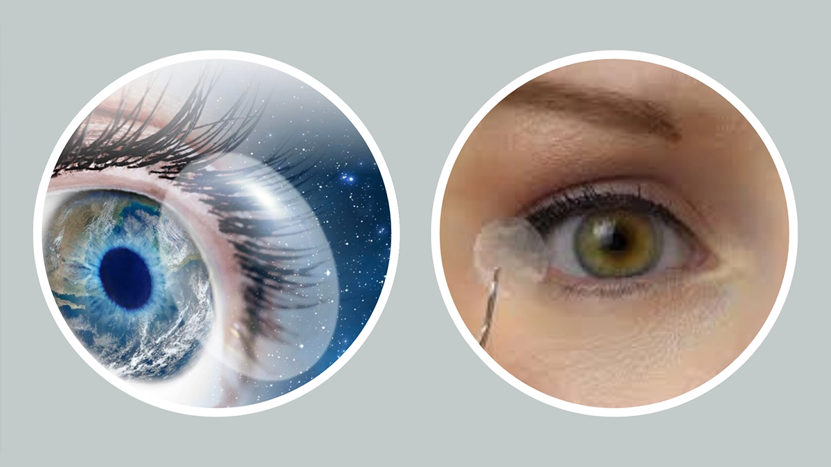 amniotic membrane eye treatment
