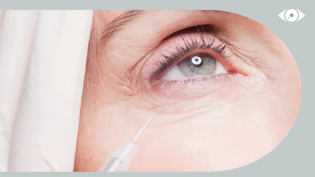 how is fibroblast therapy applied