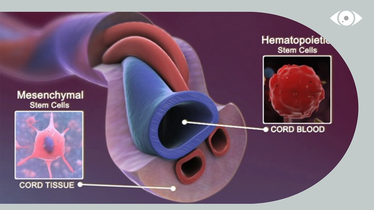 umbilical cord serum for eye treatment