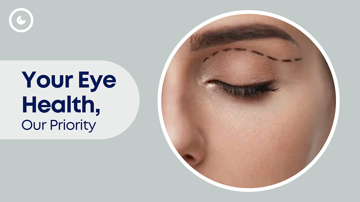 what is blepharoplasty