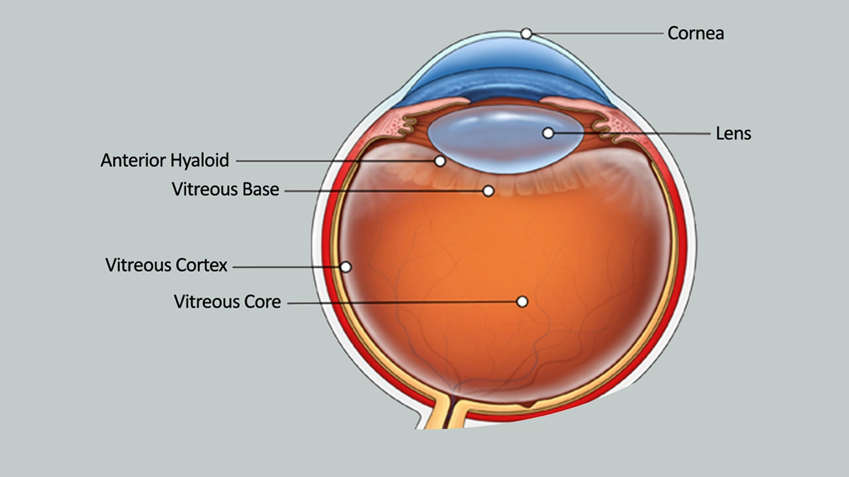 what is cataract treatment