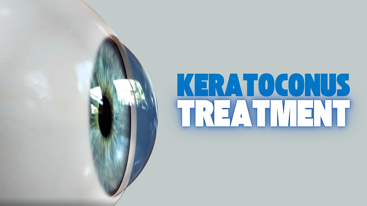 what is keratoconus treatment